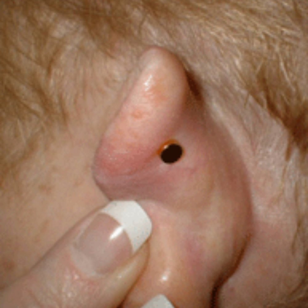 Hunger Control Acupressure Magnets - Picture 3 of 7